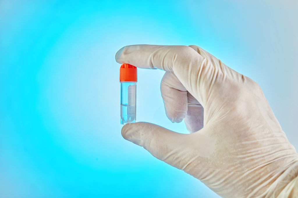 DNA test. The doctor holds a test tube with liquid for DNA analysis in the laboratory